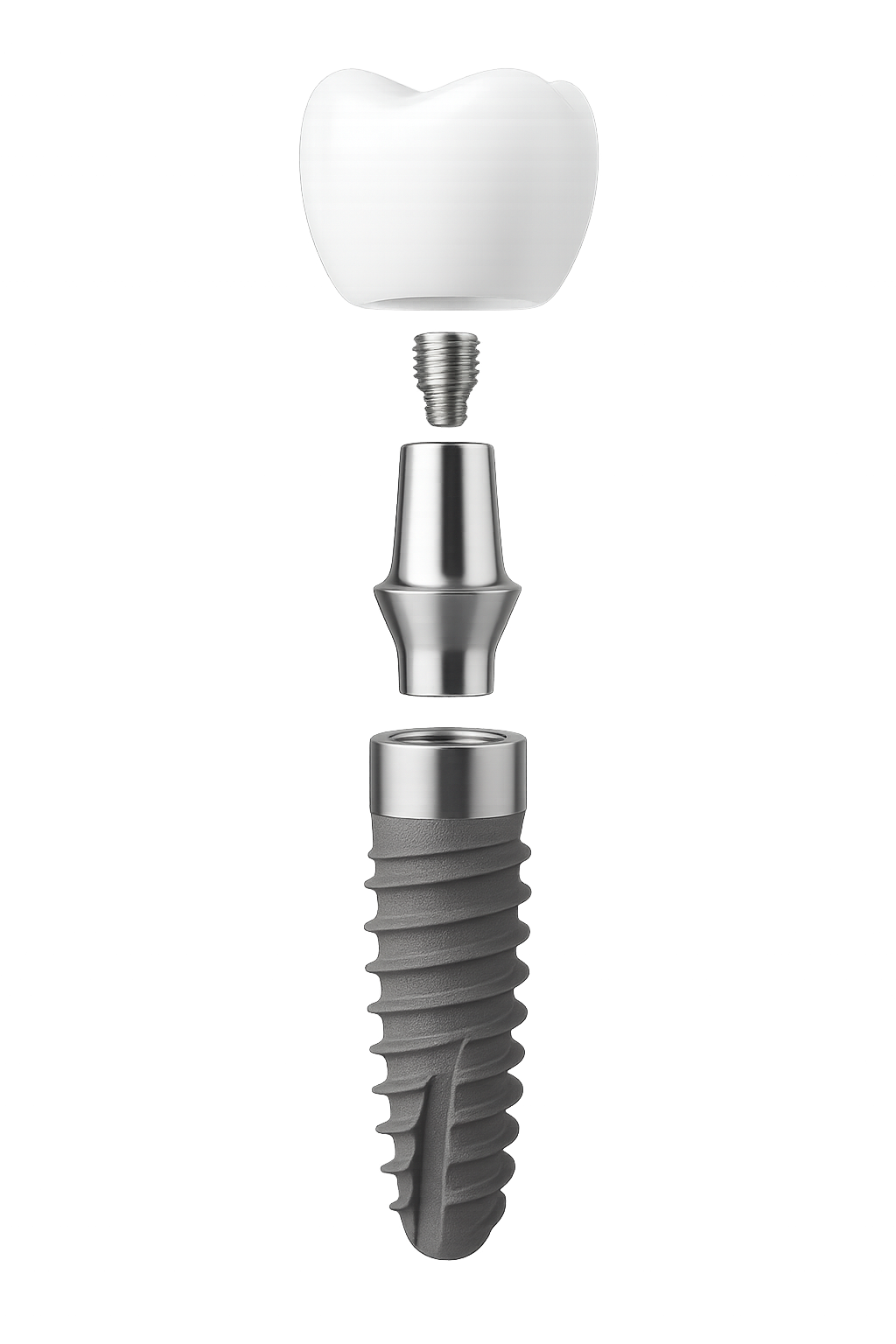 Modularer Implantataufbau